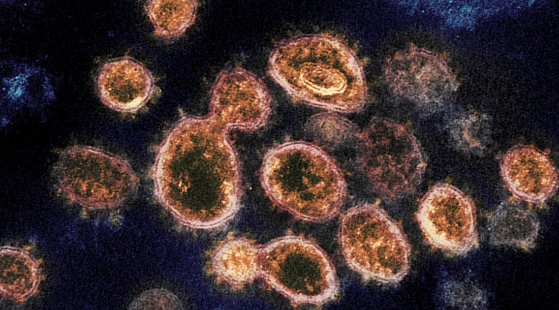 499 nouveaux décès du Coronavirus en 24 heures en France, 3523 au total