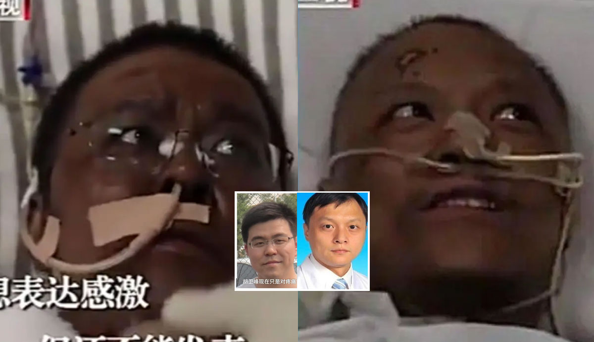 Deux médecins chinois guéris du Covid-19 et la couleur de leur peau change