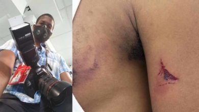 Le photojournaliste de TripFoumi Enfo Abraham Lincoln, blessé par la PNH